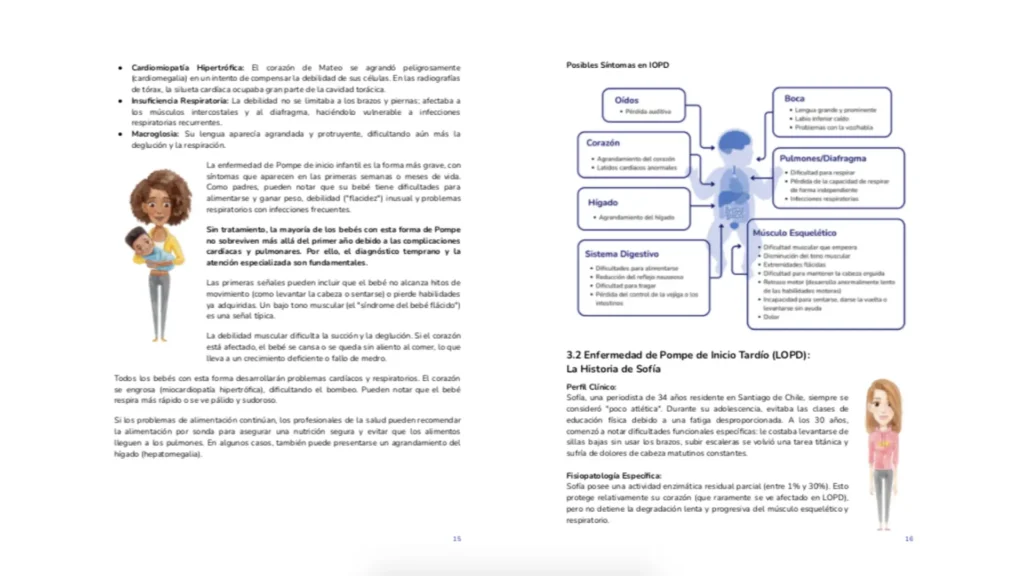 Página de muestra de la guía para la enfermedad de pompe. Doble página comparativa de síntomas. La izquierda detalla la Enfermedad de Pompe de Inicio Infantil (IOPD) con la historia de 'Mateo'; la derecha muestra un diagrama corporal de síntomas y presenta el Inicio Tardío (LOPD) con la historia de 'Sofía', ilustrando las diferencias entre ambos fenotipos.